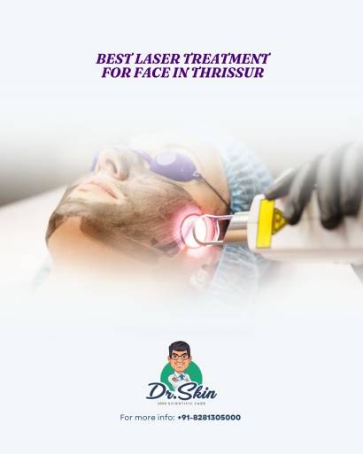 Best Laser Treatment for Face in Thrissur at Dr. Skin Clinic