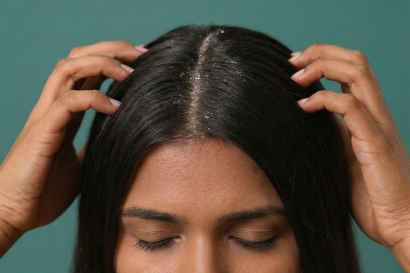 Skin Clinic In Thrissur